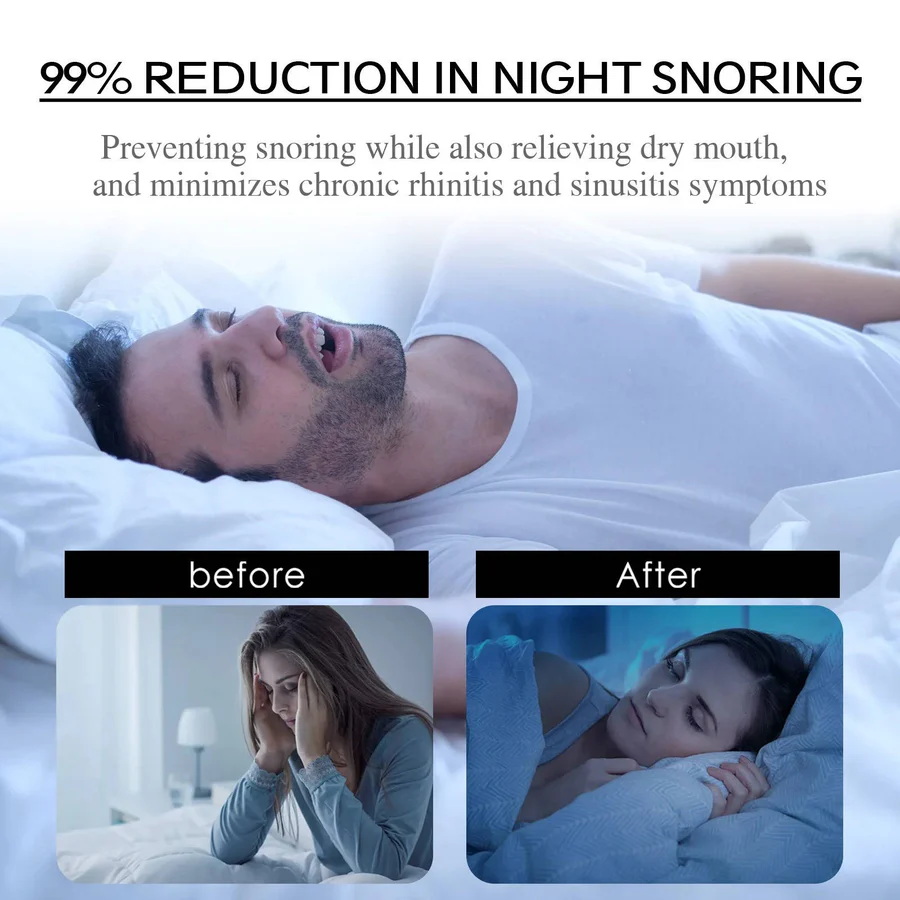 SleepGuard Strips: Breathable Anti-Snoring Solution – Taalita